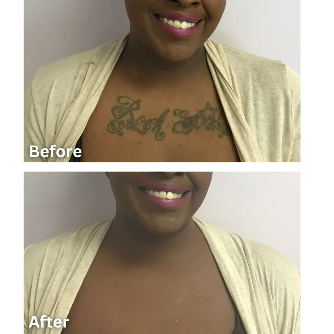 Dermaflage Tattoo Cover Up Makeup (Dark) - Bruise Full Coverage Concealer - Full Coverage Waterproof Concealer for Bruise, Scars & Acne - Smudge Proof Body Makeup Palette with 3 Pro SFX Shades   Brush