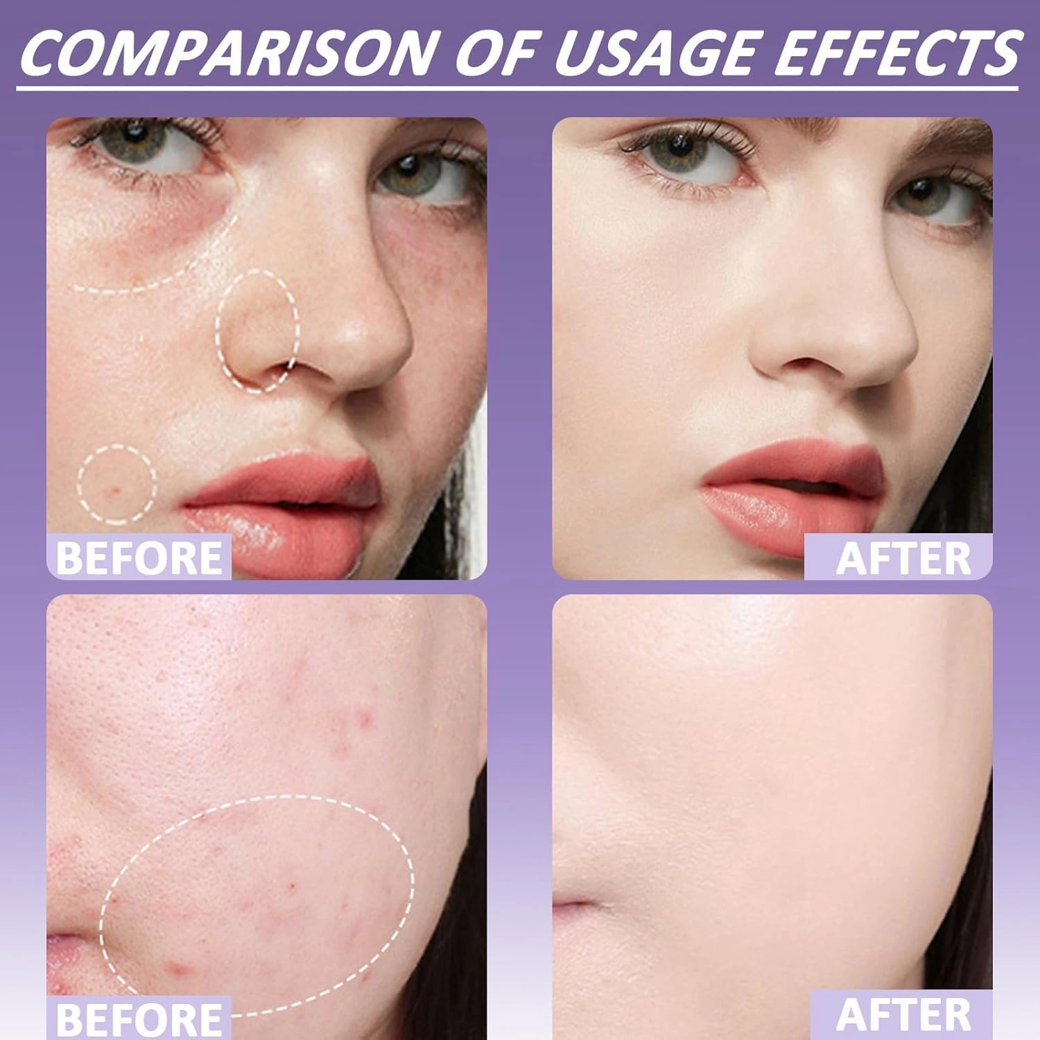 Evanesce Soft Matte Cream Concealer, Evanesce Soft Matte Cream Foundation, Waterproof Foundation, Full Coverage, Hydrating Long-Lasting Concealer (Ivory Natural, One Size)