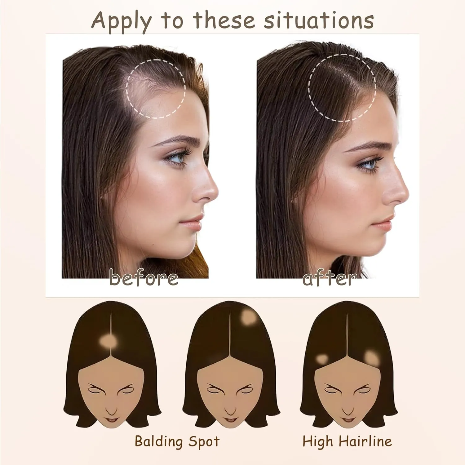 human hair bald spot hair patch toupee scar human hair replacement hairline loss straight Tape for men and women (Light Brown, 0.78"*1.57")