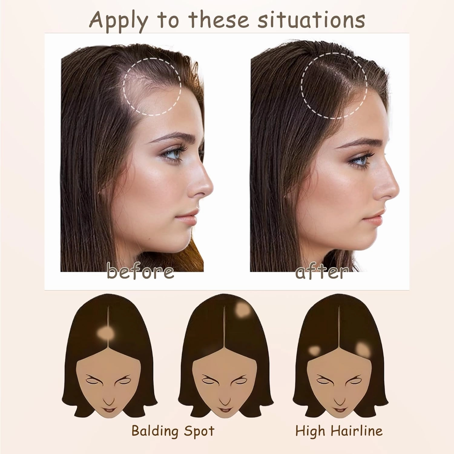 human hair bald spot hair patch toupee scar humanhair replacement hairline loss straight Tape for men and women (Medium Brown, 1.57"*1.57")