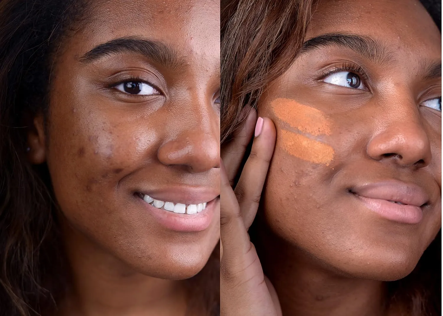 Loves-You-Back 3in1 Mineral Powder Foundation (CARAMEL 4) | Designed for Acne-Prone, Sensitive Skin | Hyperpigmentation | Covers Dark Circles | 3IN1 - Concealer, Foundation   Powder