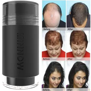MINNOW Hair Building Fibers,Keratin Hair Fibers Hair Loss Concealer For Thinning Hair Powder Volumizing Based,16grams/0.56oz (GRAY)