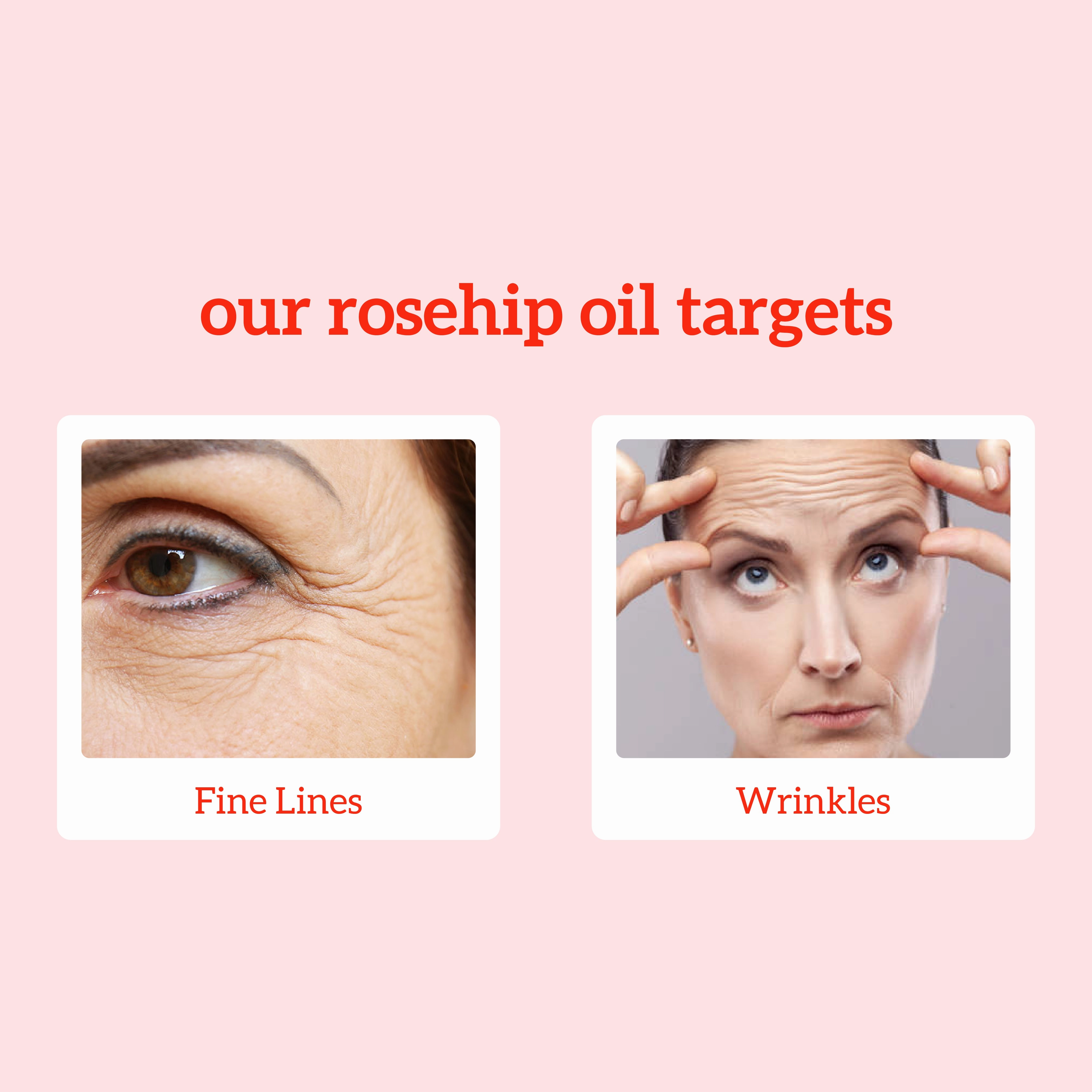 Rosehip Oil - 30ml